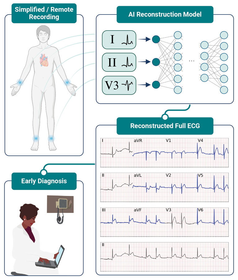 ECG Reconstruction