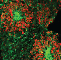 Brain organoids were healthy and continued to grow after spending a month on the International Space Station. (Credit: Jeanne Loring).