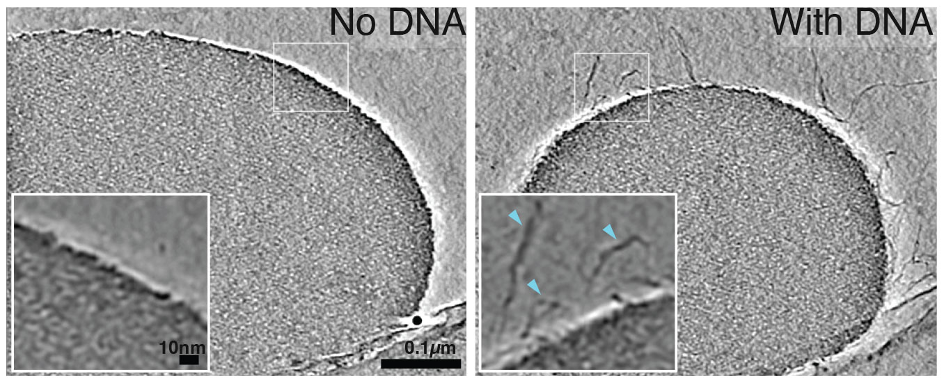 Cryo-electron tomography