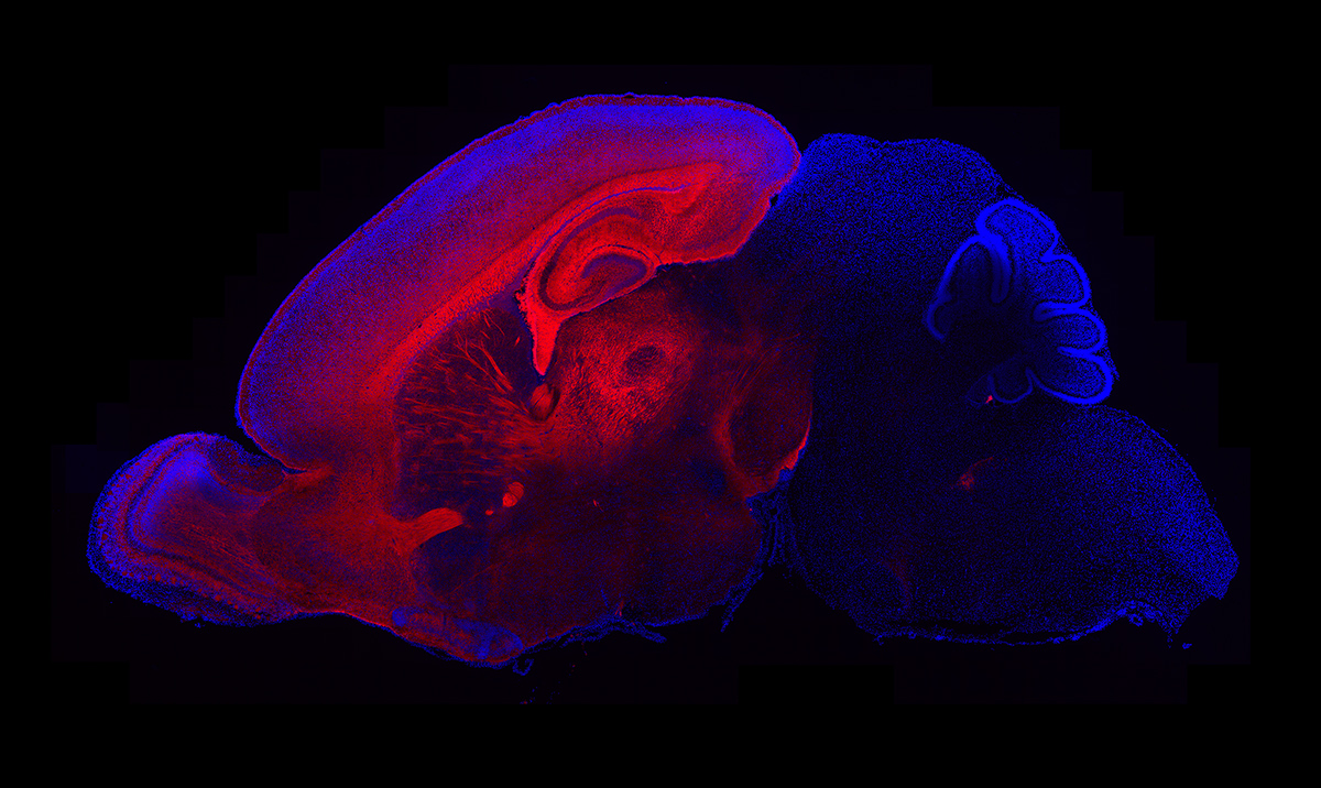 A team from The Scripps Research Institute found that mutations in the autism risk gene PTEN led to a sequential overproduction of the neurons and glia that build the cerebral cortex (visualized here using a red fluorescent reporter).